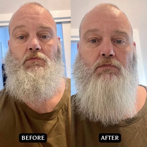 Beard/Hair Straightener - 2 in 1