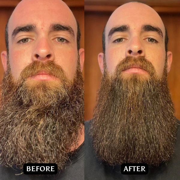 Beard/Hair Straightener - 2 in 1